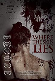 Where the Skin Lie