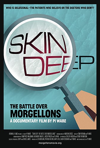 Skin Deep: The Bat
