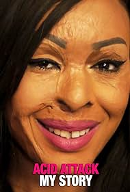 Acid Attack My Sto