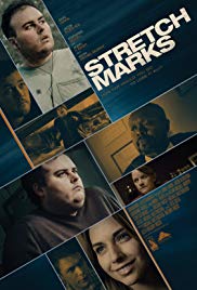 Stretch Marks (201